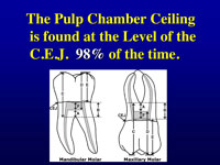 Pulp Chamber Morphology Basic Research Leads To Clinical Technique