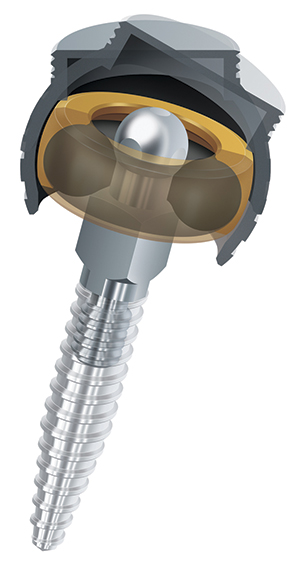 O-Ring Mini Implant Analog #2M– ROE Dental Laboratory