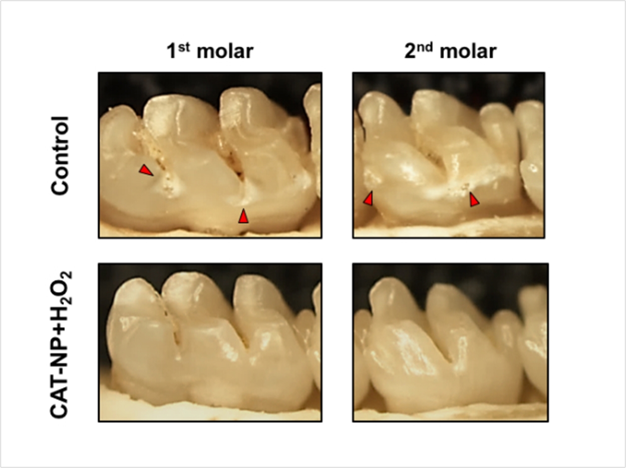 cavity side of molar