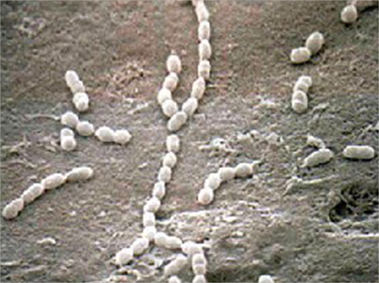 Streptococcus gordonii by Lloyd G. Simonson, ASM MicrobeLibrary.