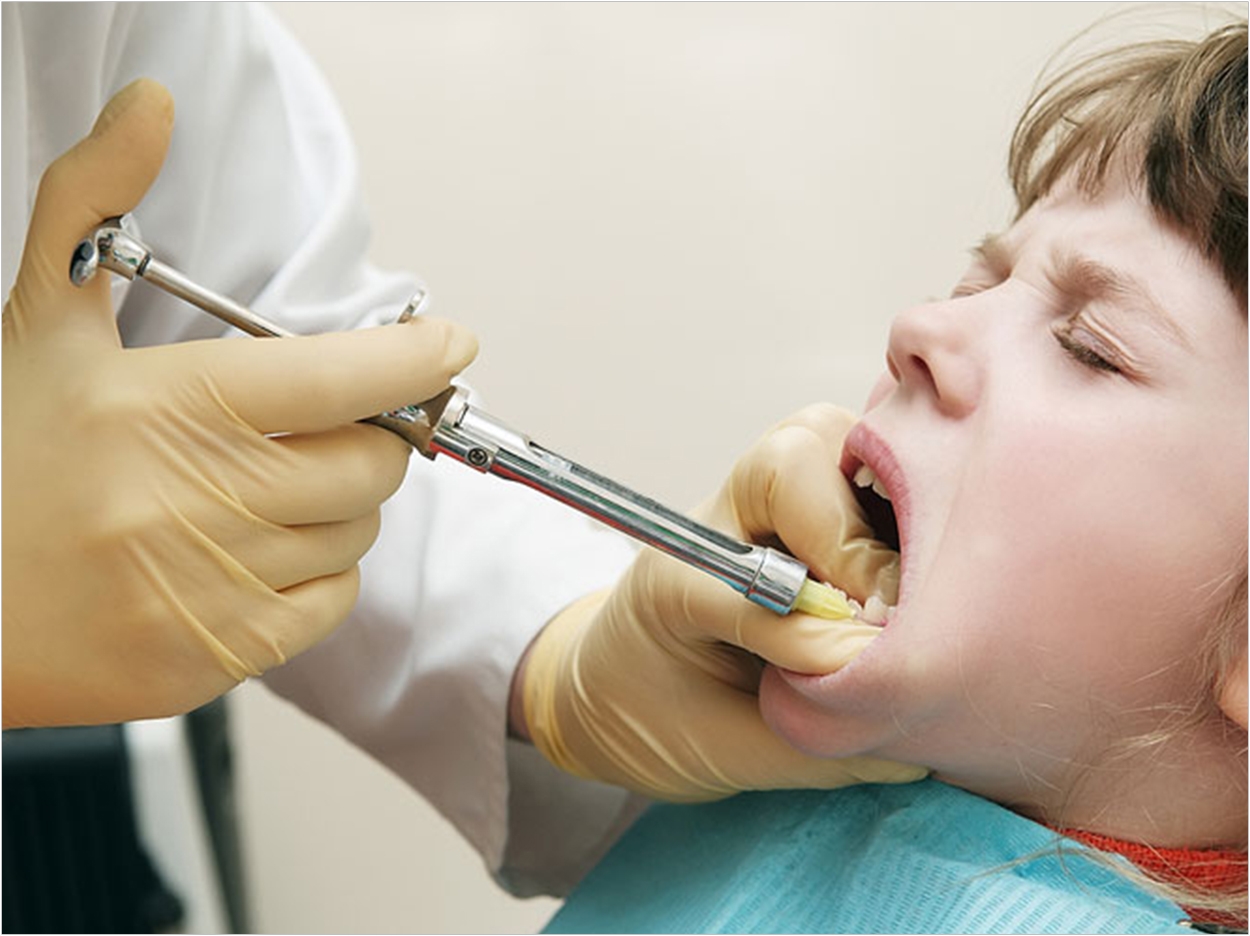 Удаление зубов какой врач
