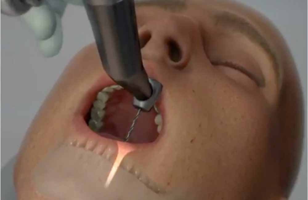 Jogar Operate Now! Dental Implant - Jogue Operate Now! Dental