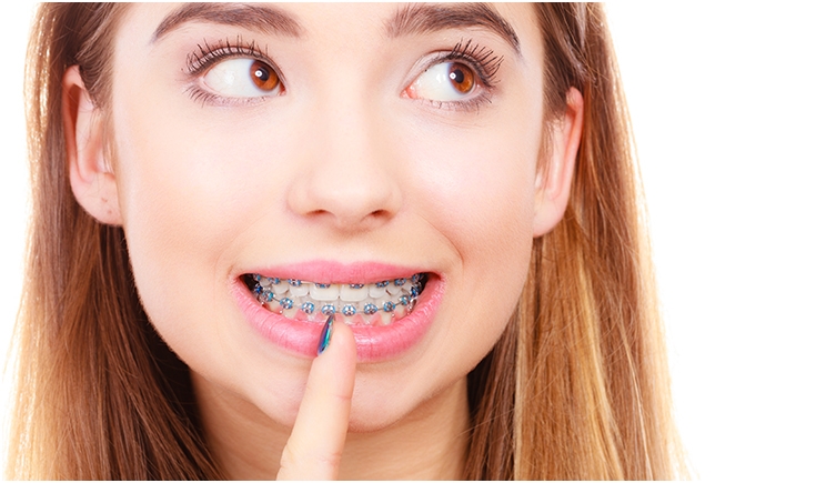 How to Boost Compliance Among Your Orthodontic Patients - Dentistry Today