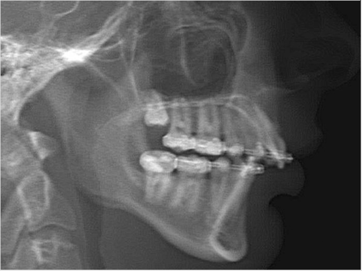 Photo courtesy of the Journal of Oral and Maxillofacial Surgery