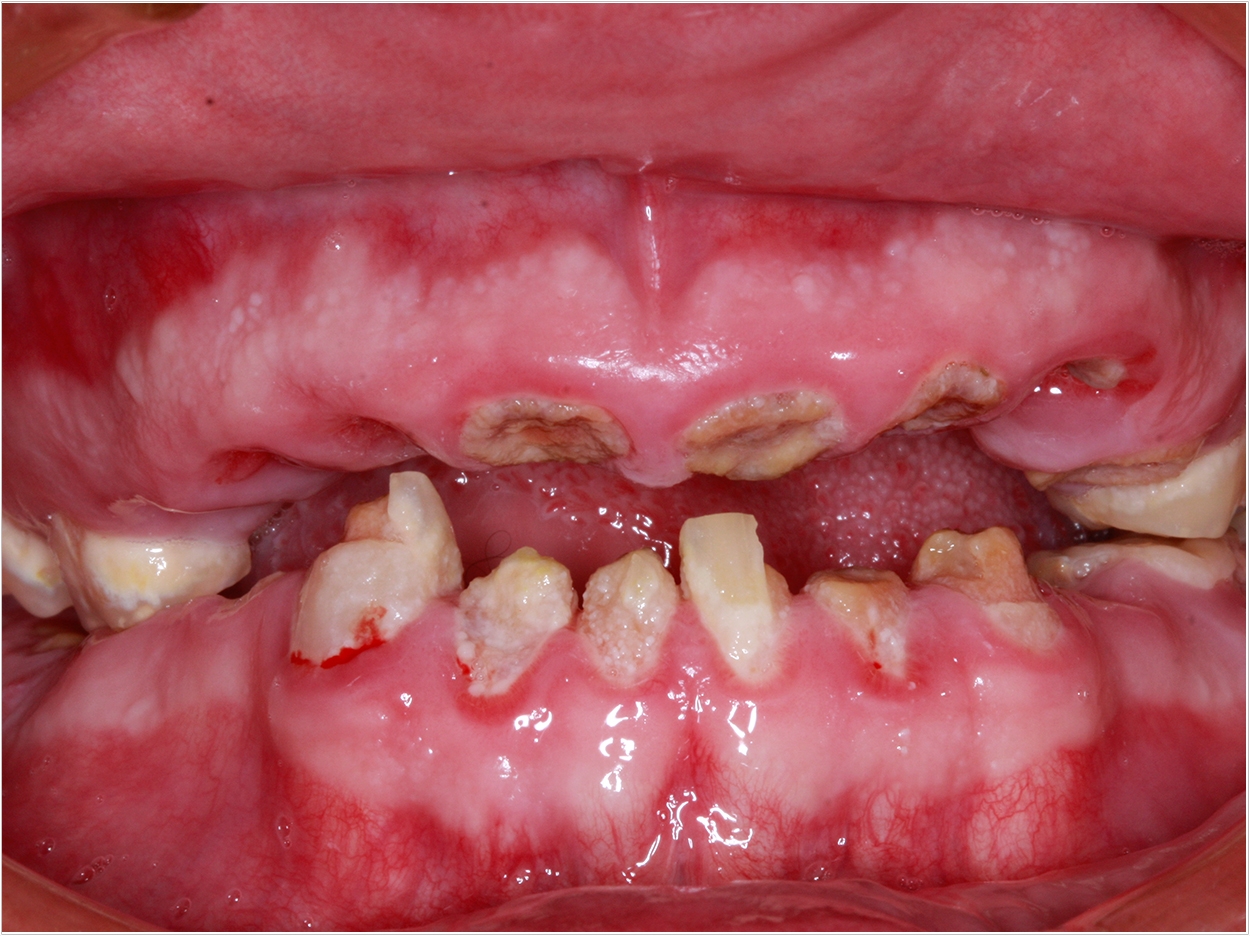 Photo by Dr. Richard Winter; https://www.dentistrytoday.com/articles/10549