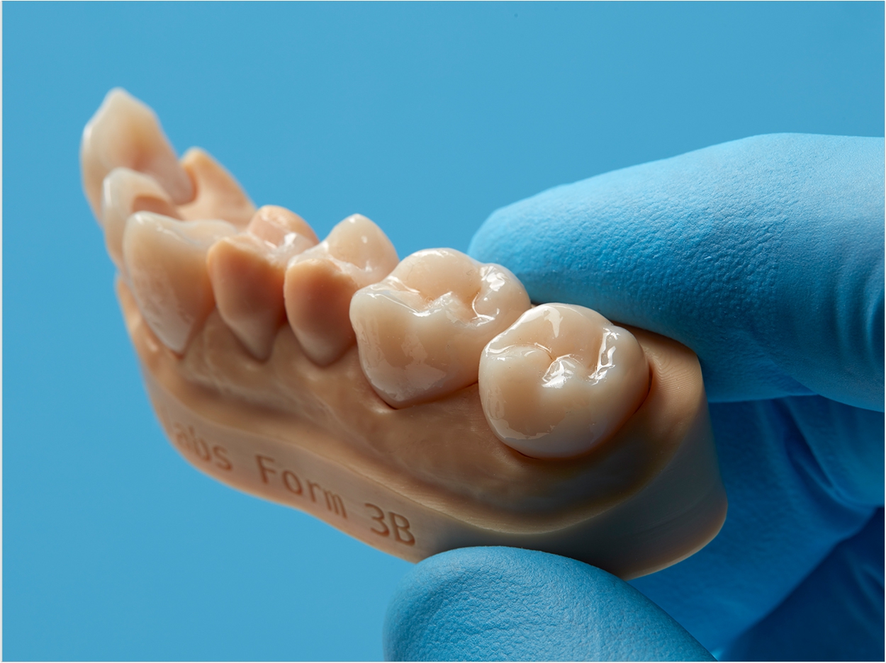 3-D Printing Resin Designed Permanent - Dentistry