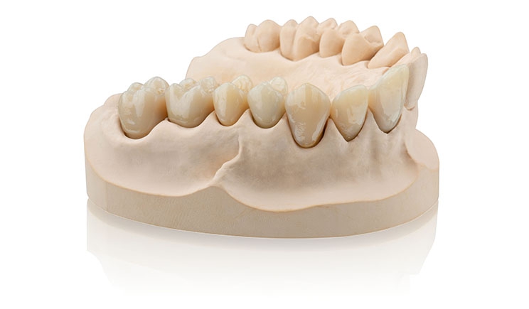 Răng giả in 3d trong tự chủ nha khoa