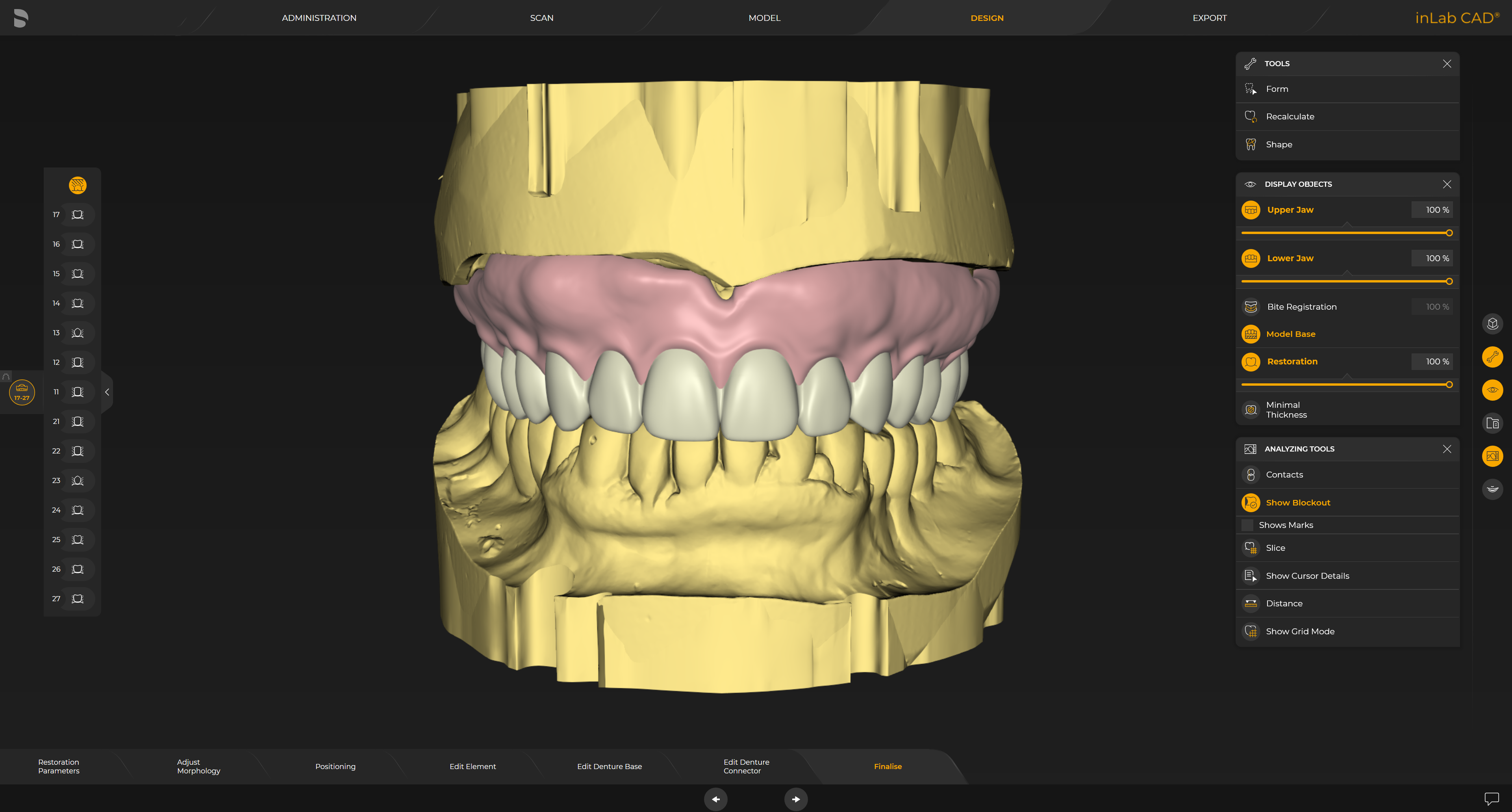 New inLab Software 22.0: Widens Production Range