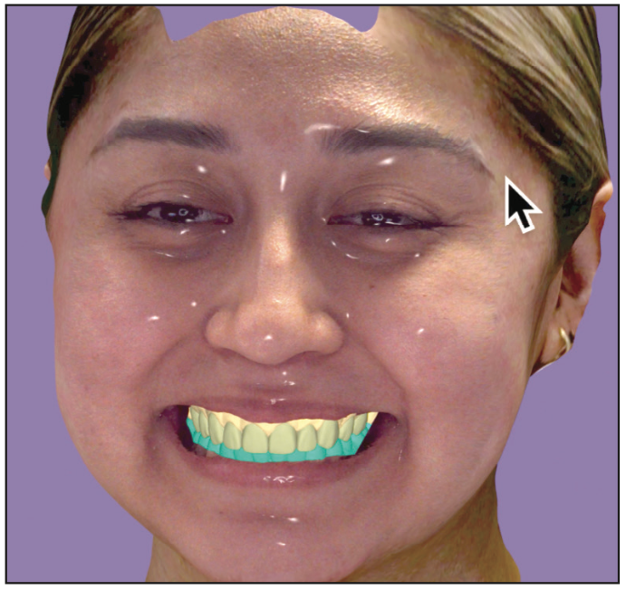Three-Dimensional Facial Scanning