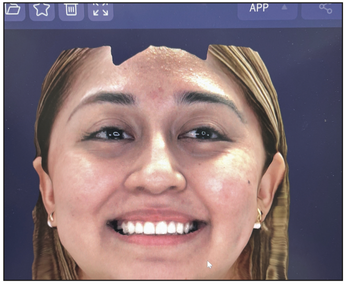 Three-Dimensional Facial Scanning