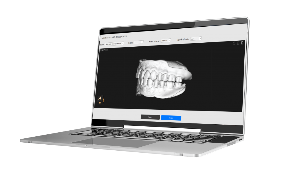 Easy Digital Denture Solution (EDDS)