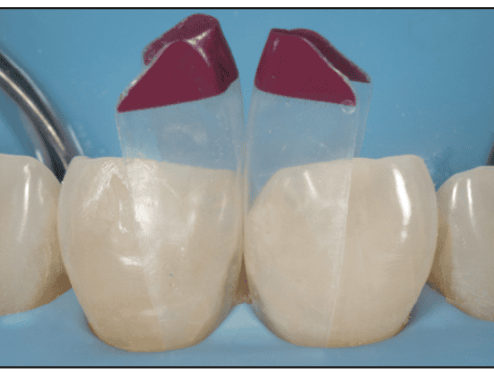 restorative dentistry