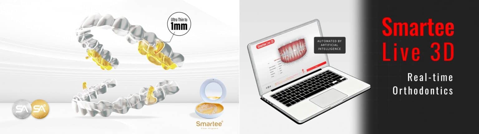 Smartee Marks Transformational Year in 2025 - Dentistry Today